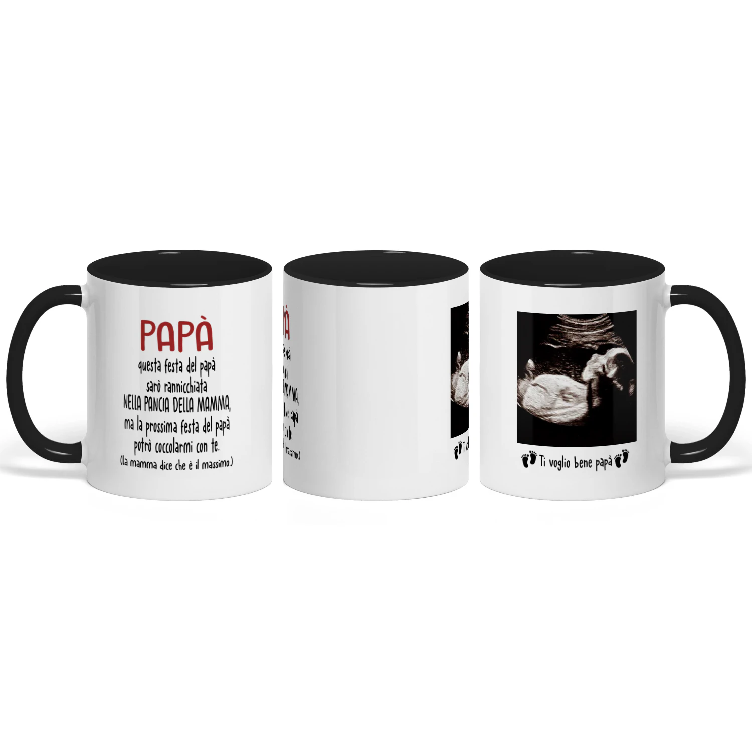 Tazza Personalizzata Futuro Papà | Regalo Prima Festa Del Papà | Tazza Di Caffè Con L'immagine Ad Ecografia Del Bambino