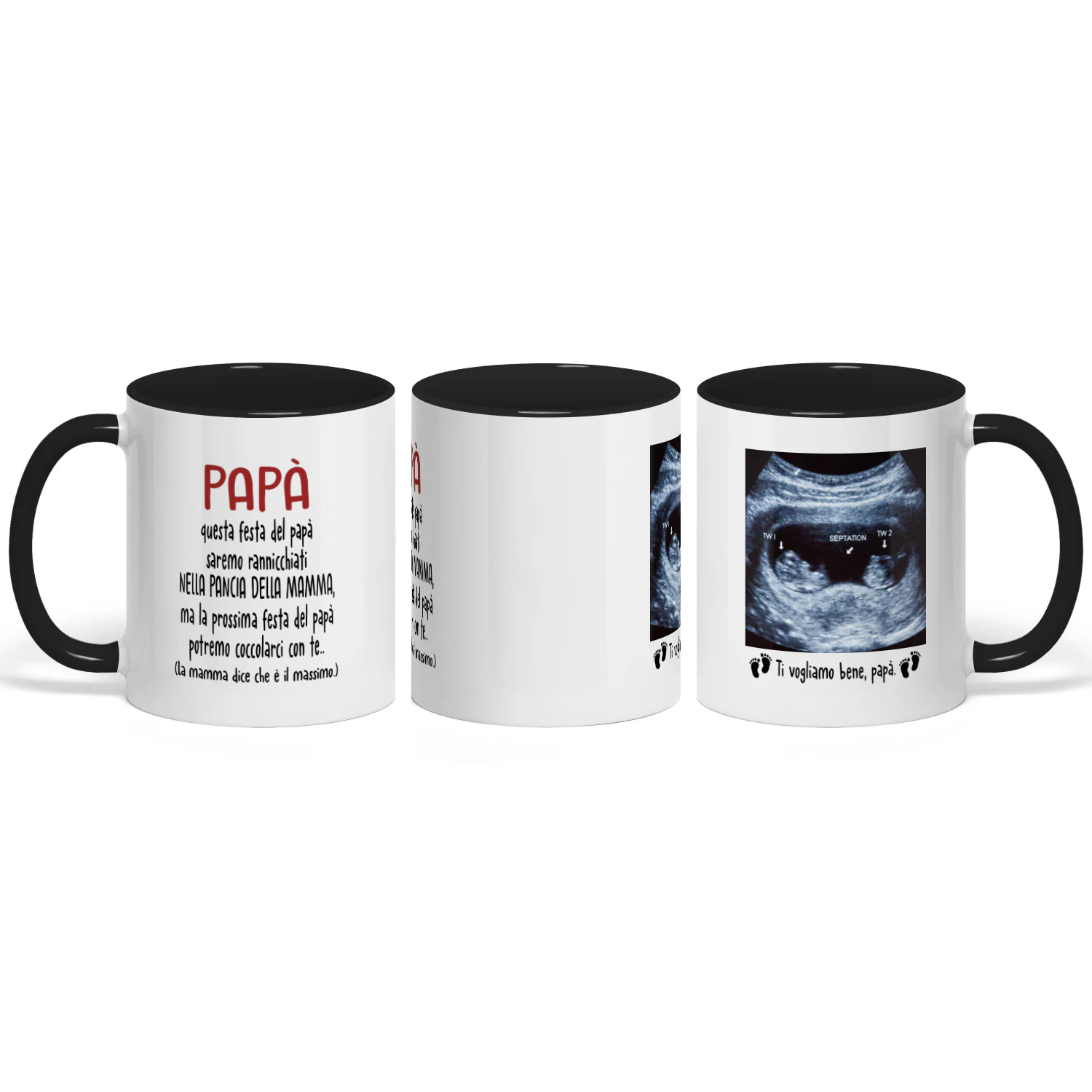 Tazza Personalizzata Futuro Papà | Regalo Prima Festa Del Papà | Tazza Di Caffè Con L'immagine Ad Ecografia Del Bambino