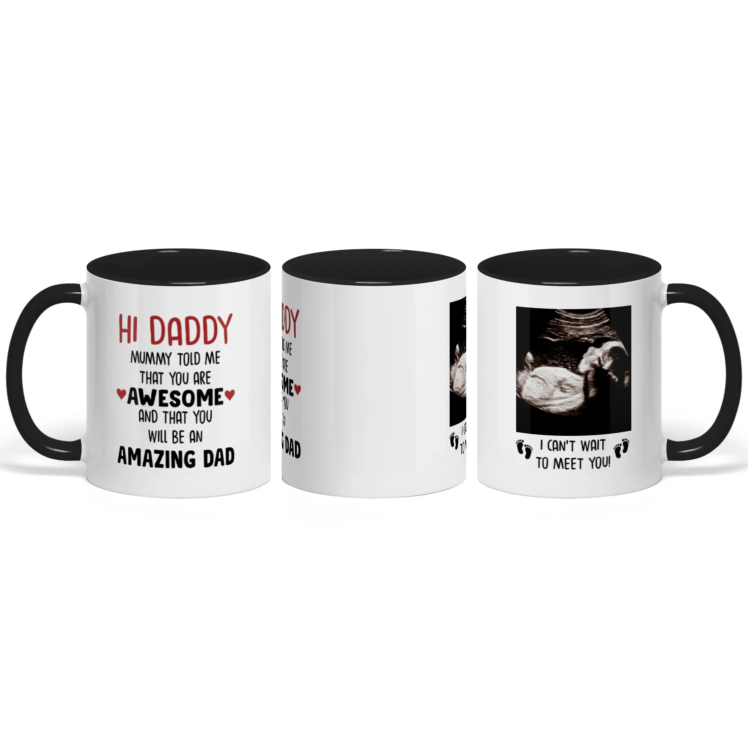 Custom Two Tone Mug For Dad To Be | First Father's Day Gift For Expectant Father | Personalized Coffee Mug With Ultrasound Picture