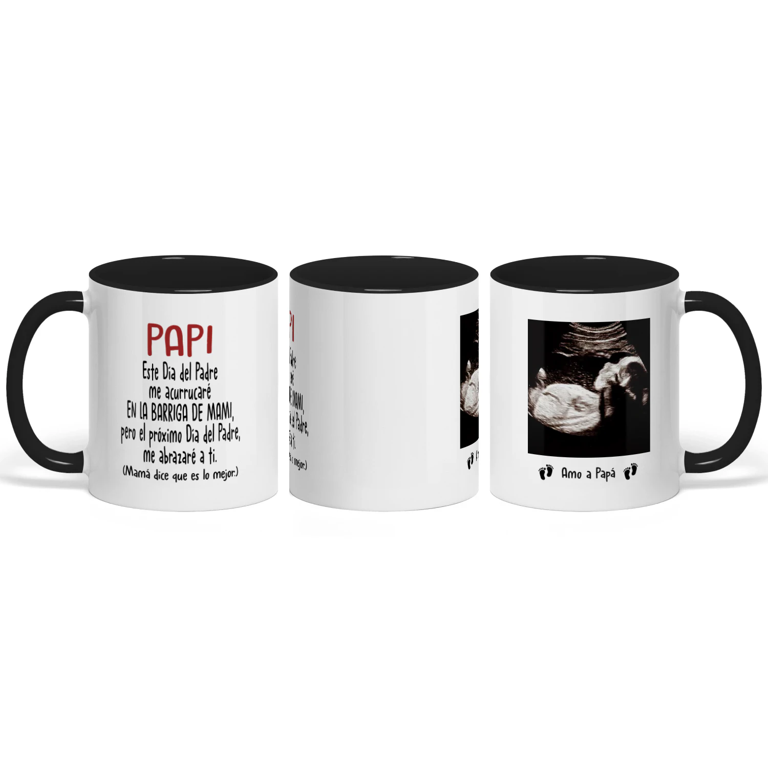 Taza Personalizada Para Futuro Papa | Regalos Para El Primer Día Del Padre | Taza De Café Con La Imagen Del Ultrasonido Del Bebé