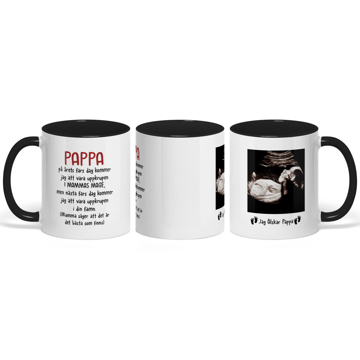 Personlig Mugg Till Blivande Pappa | Första Fars Dag Present | KaffeMugg Med Ultraljudsbild Av Bebis