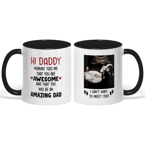 Custom Two Tone Mug For Dad To Be | First Father's Day Gift For Expectant Father | Personalized Coffee Mug With Ultrasound Picture