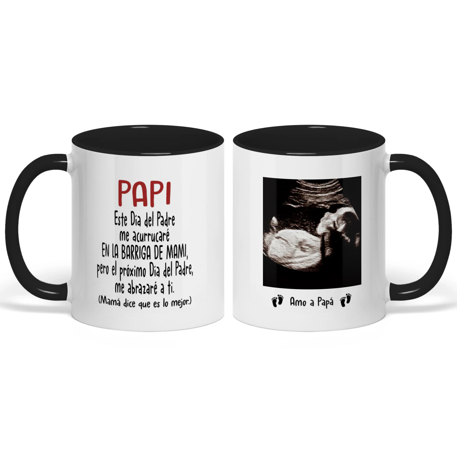 Taza Personalizada Para Futuro Papa | Regalos Para El Primer Día Del Padre | Taza De Café Con La Imagen Del Ultrasonido Del Bebé