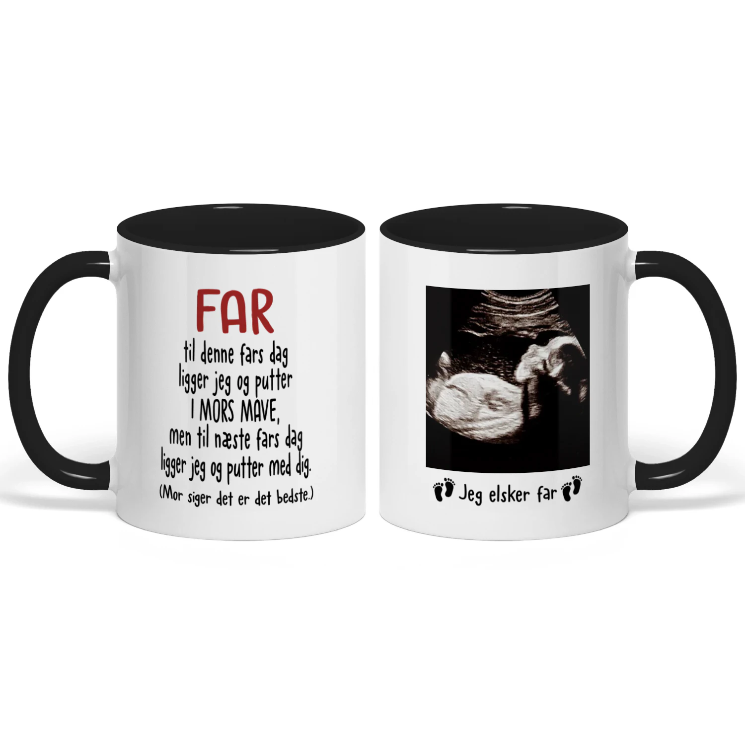Personlig Krus Til Kommende Far | Første Fars Dag Gave | Kaffekrus Med Ultralydsbillede Af Baby