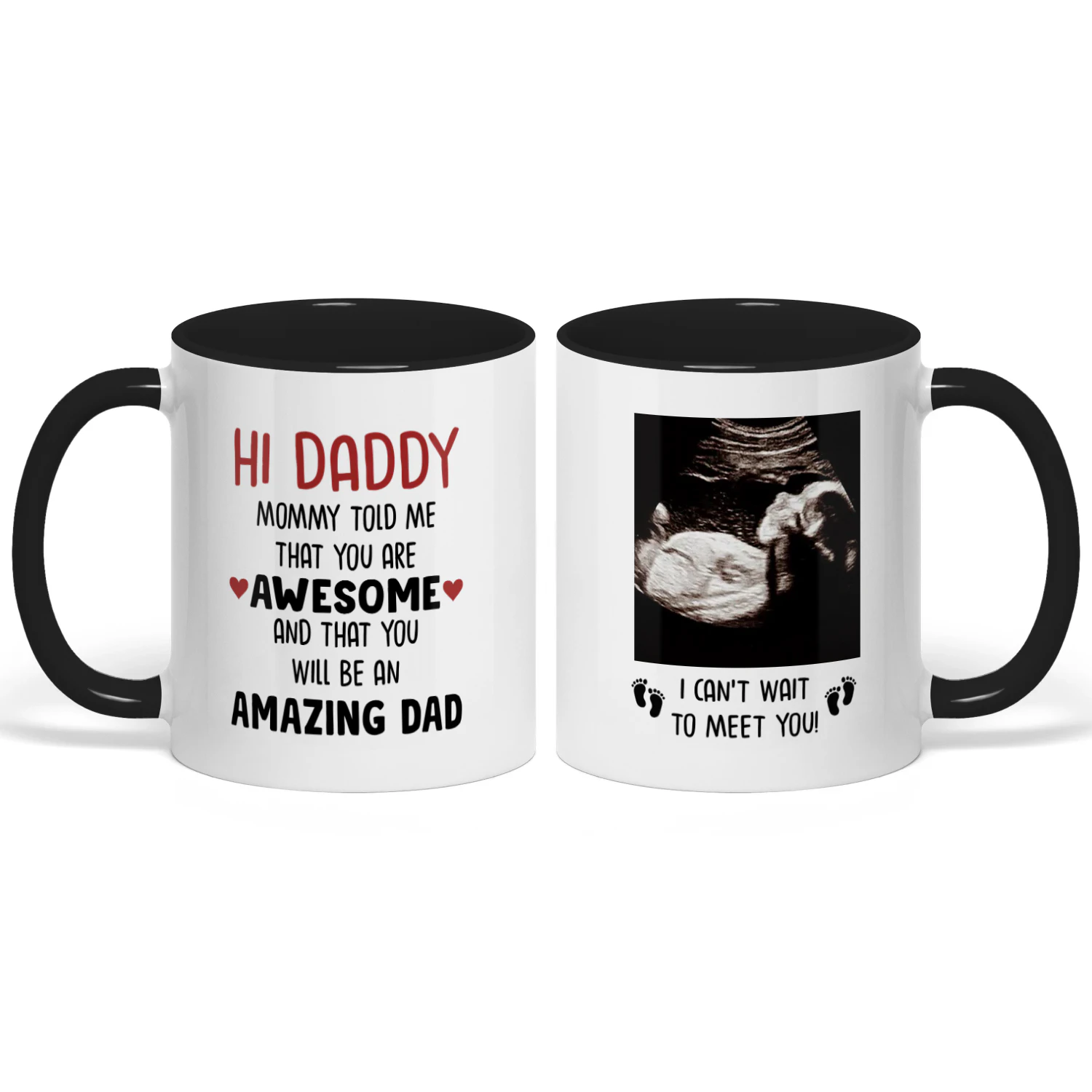 Custom Two Tone Mug For Dad To Be | First Father's Day Gift For Expectant Father | Personalized Coffee Mug With Ultrasound Picture
