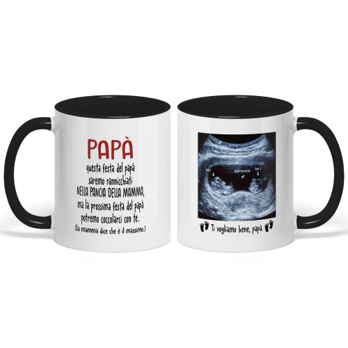 Tazza Personalizzata Futuro Papà | Regalo Prima Festa Del Papà | Tazza Di Caffè Con L'immagine Ad Ecografia Del Bambino