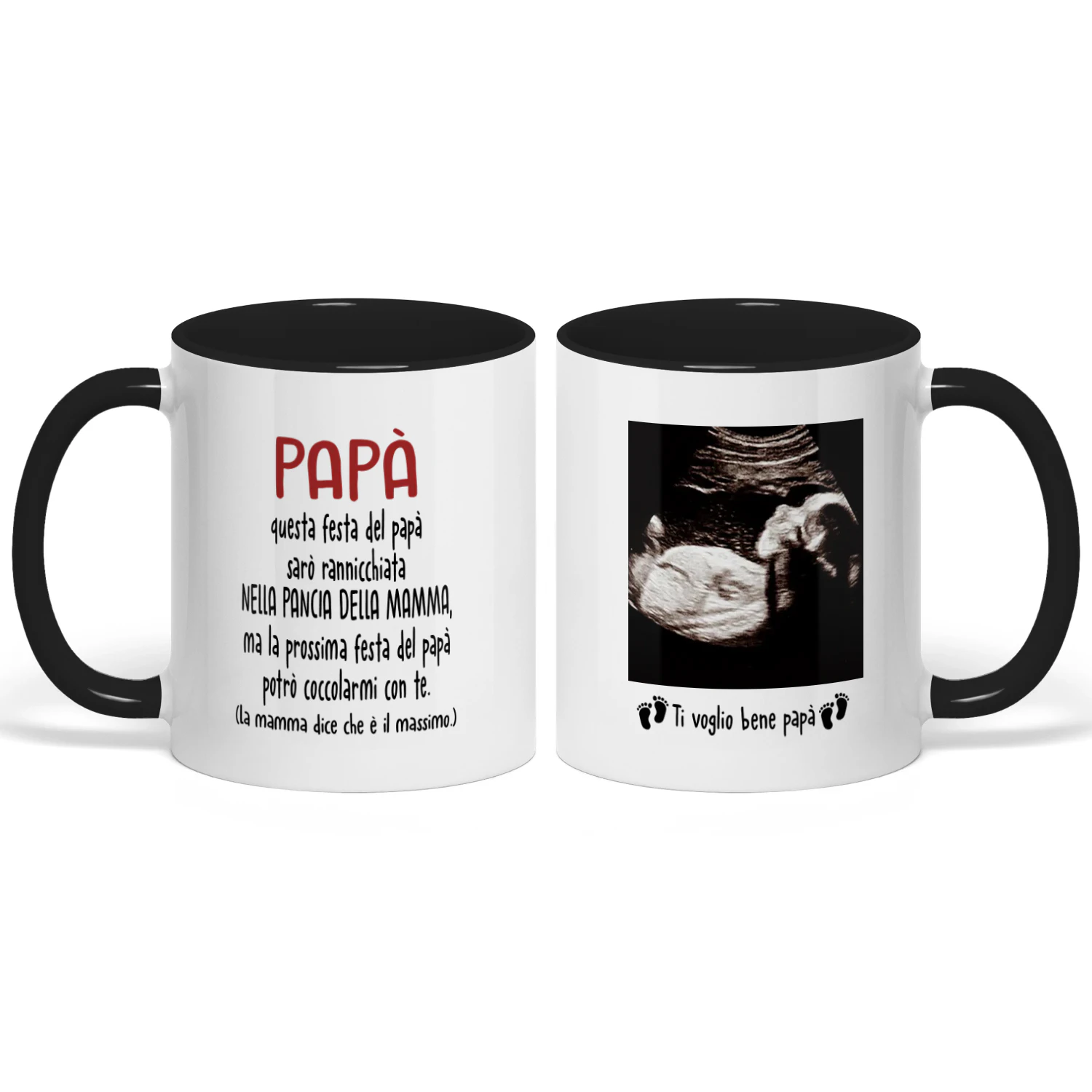 Tazza Personalizzata Futuro Papà | Regalo Prima Festa Del Papà | Tazza Di Caffè Con L'immagine Ad Ecografia Del Bambino