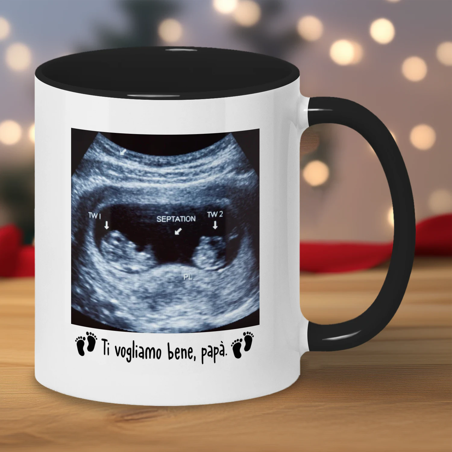 Tazza Personalizzata Futuro Papà | Regalo Prima Festa Del Papà | Tazza Di Caffè Con L'immagine Ad Ecografia Del Bambino