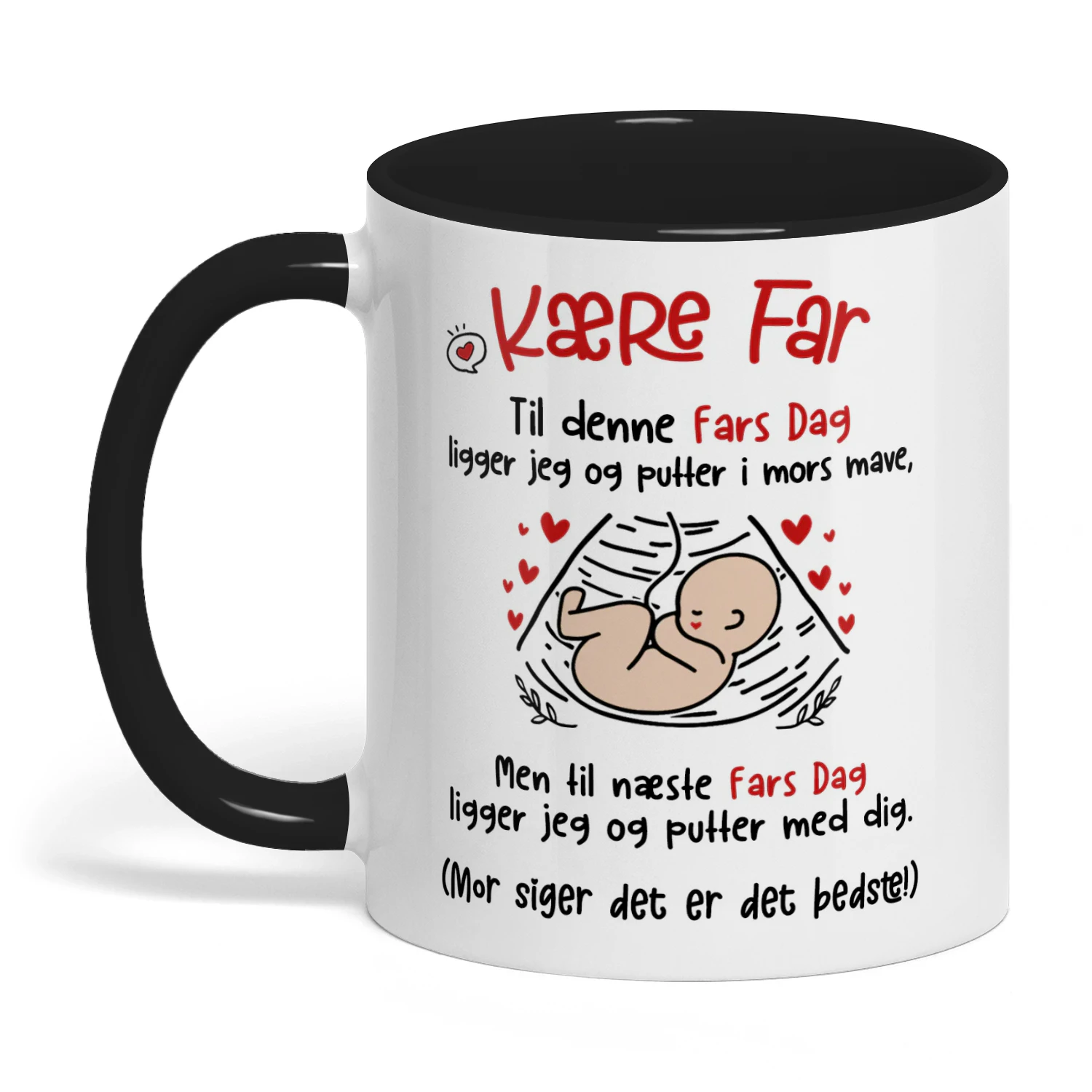 Personligt tofarvet krus til kommende far | Første farsdagsgave til den kommende papa | Personligt kaffekrus med ultralydsfoto