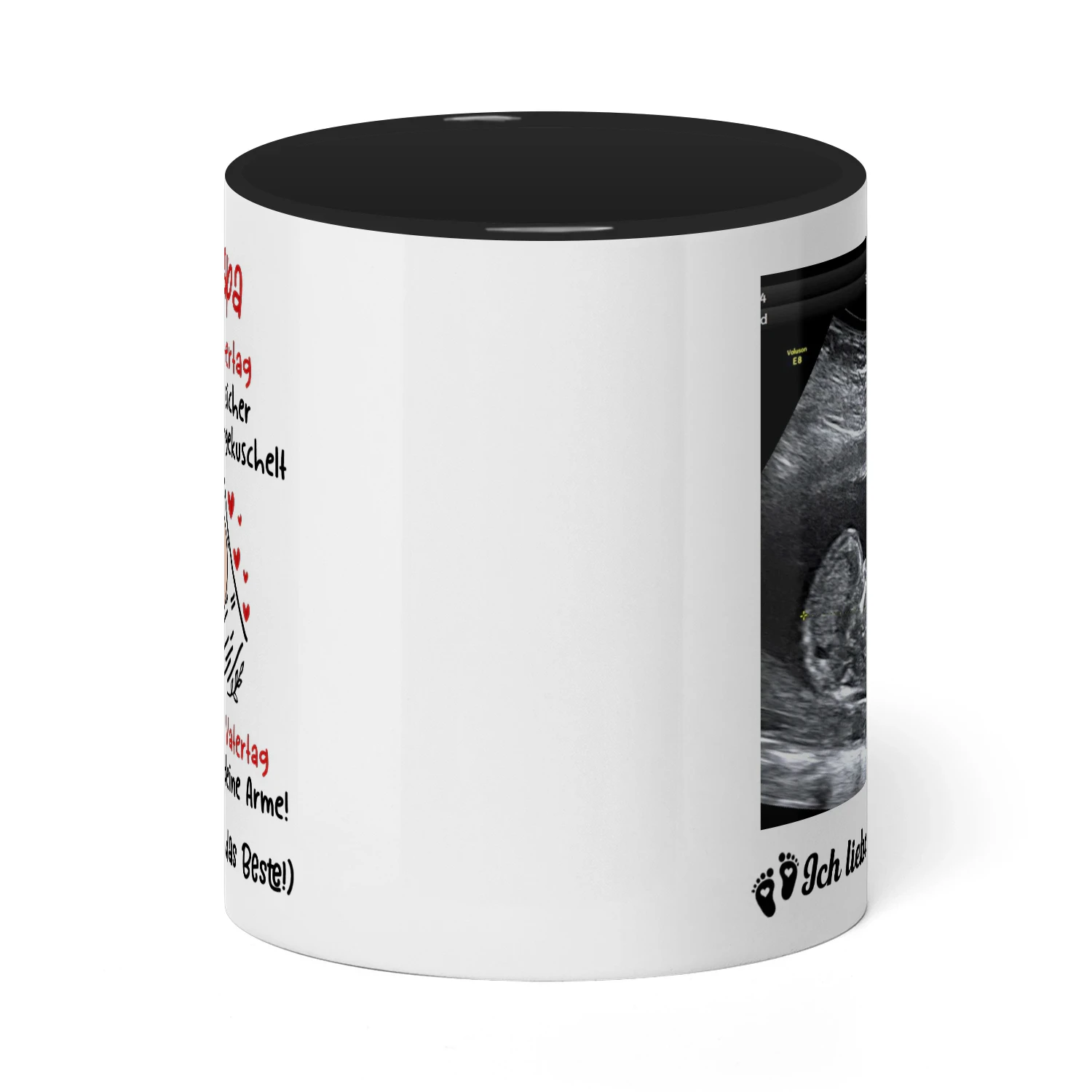Personalisierter zweifarbiger Becher für werdende Väter | Geschenk zum ersten Vatertag für werdende Väter | Personalisierter Kaffeebecher mit Ultraschallbild
