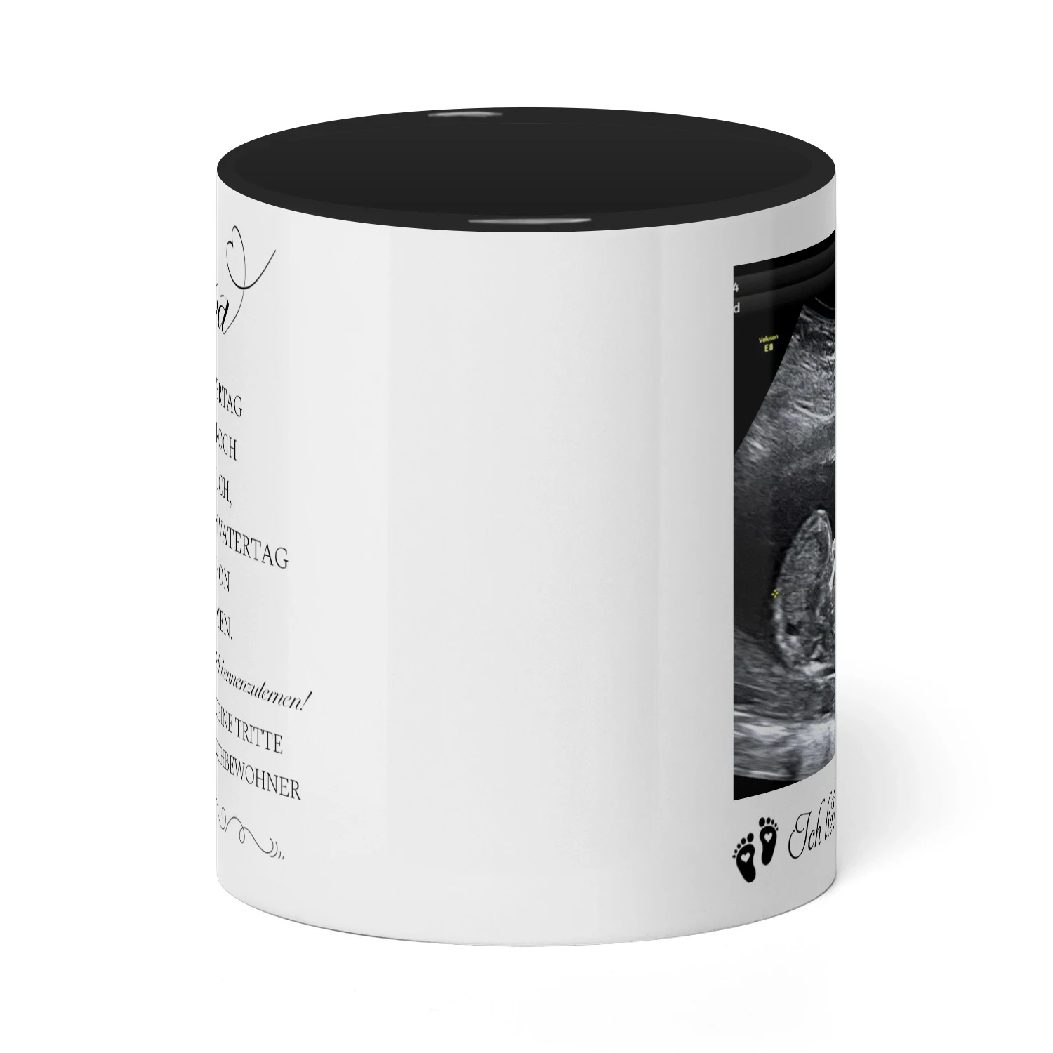 Personalisierte Tasse für werdenden Papa mit Ultraschallbild | Geschenk zum ersten Vatertag | Tasse für werdenden Vater