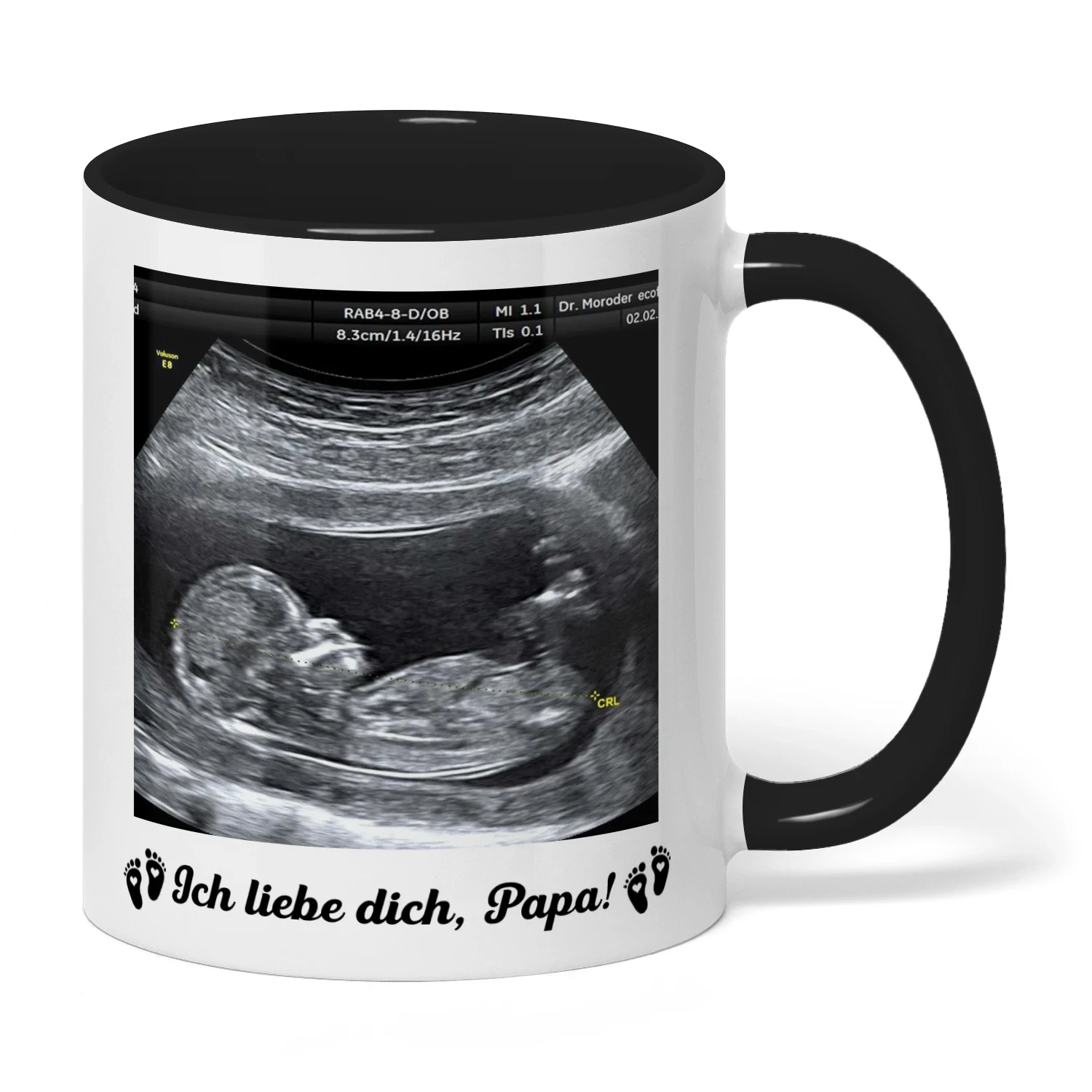 Personalisierte Tasse für werdenden Papa mit Ultraschallbild | Geschenk zum ersten Vatertag | Tasse für werdenden Vater