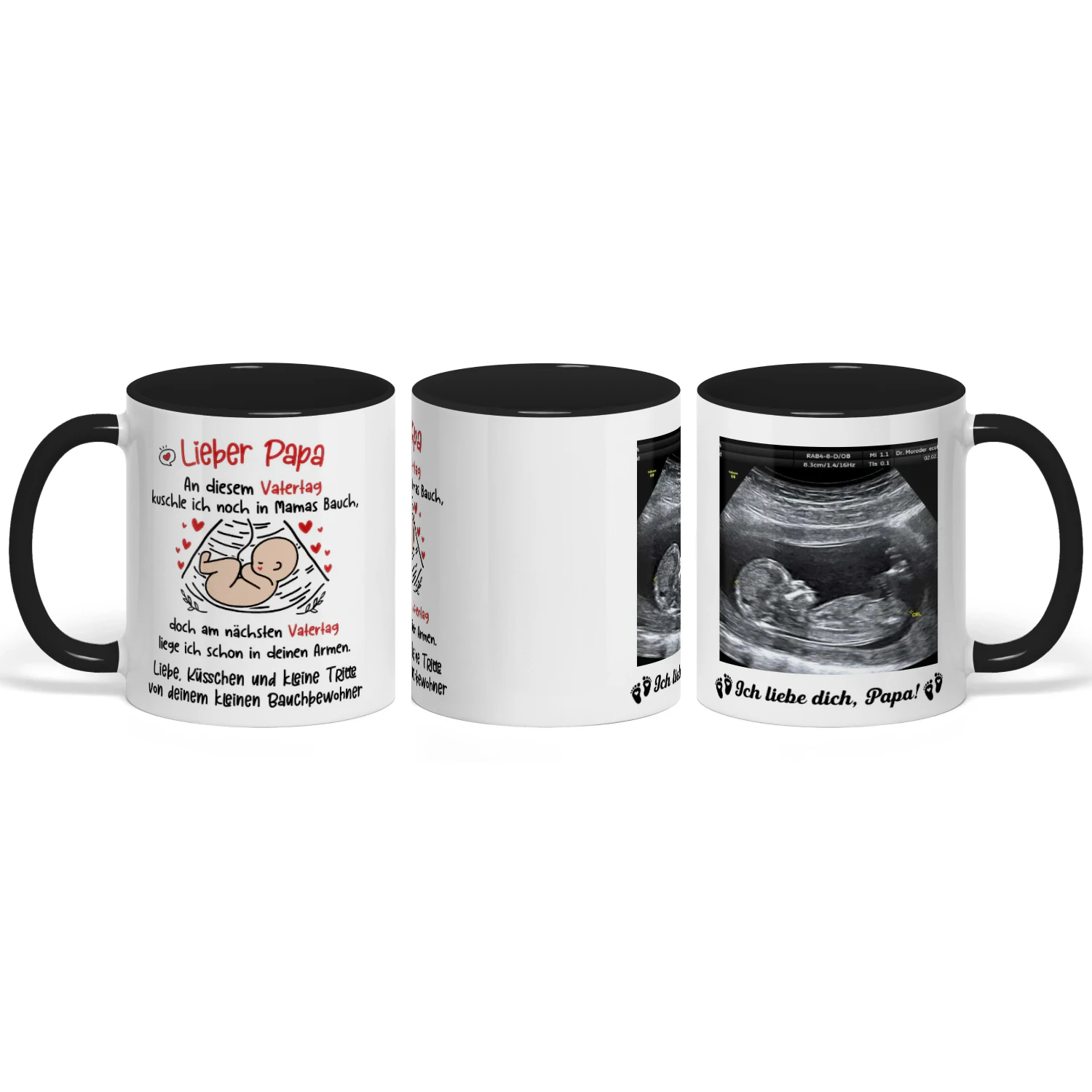 Personalisierte Tasse für werdenden Papa mit Ultraschallbild | Geschenk zum ersten Vatertag | Tasse für werdenden Vater