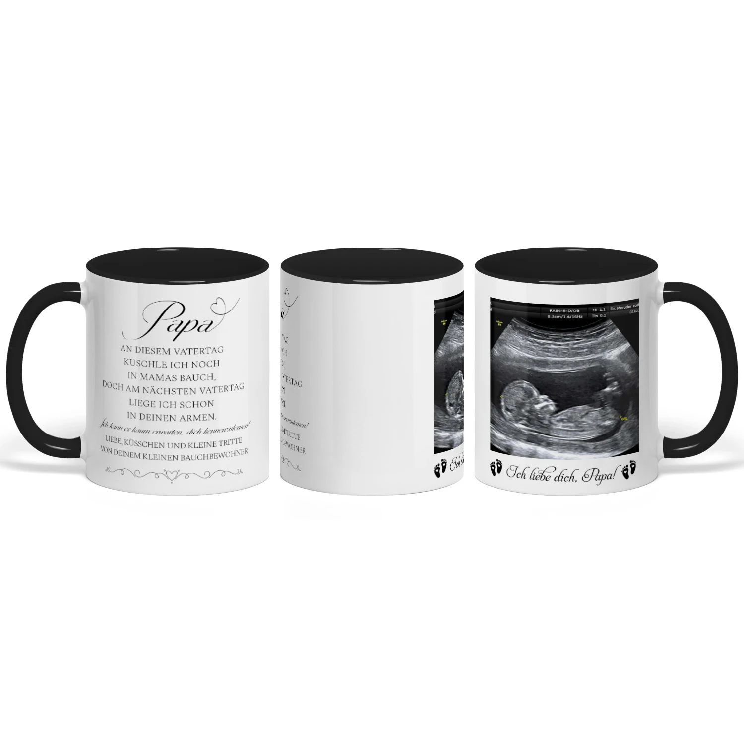 Personalisierte Tasse für werdenden Papa mit Ultraschallbild | Geschenk zum ersten Vatertag | Tasse für werdenden Vater