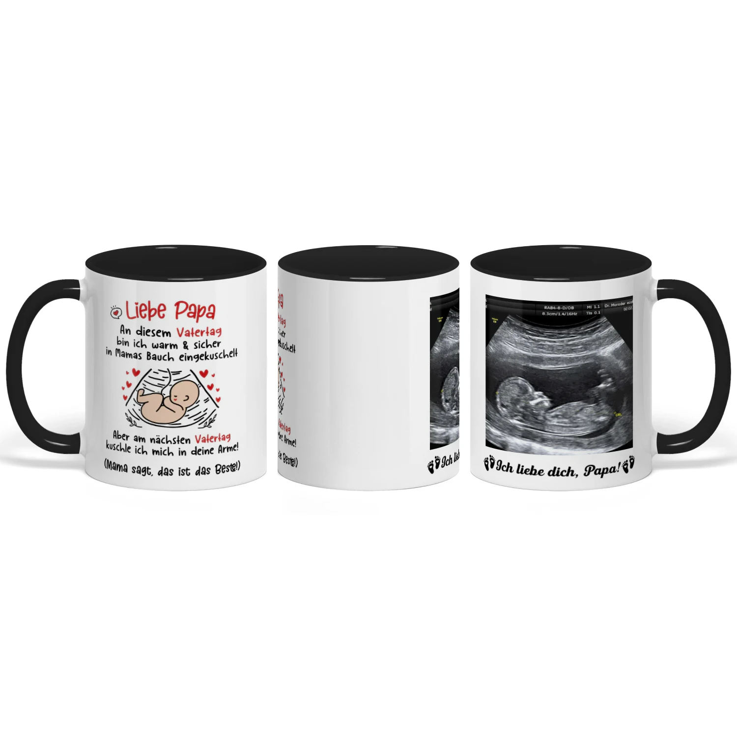 Personalisierter zweifarbiger Becher für werdende Väter | Geschenk zum ersten Vatertag für werdende Väter | Personalisierter Kaffeebecher mit Ultraschallbild