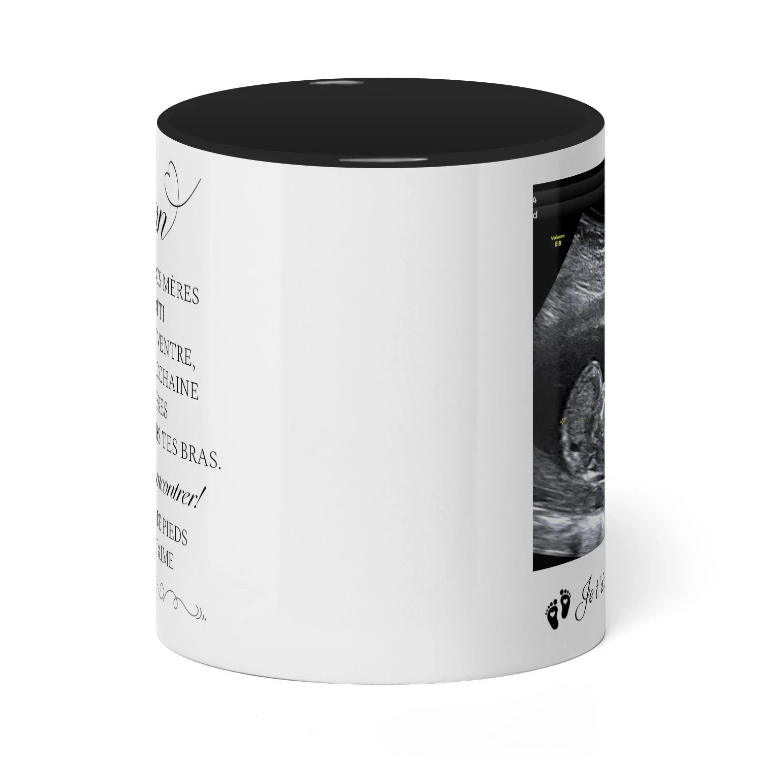 Mug bicolore personnalisé pour future maman | Premier cadeau de Fête des Mères pour femme enceinte | Tasse avec photo d’échographie