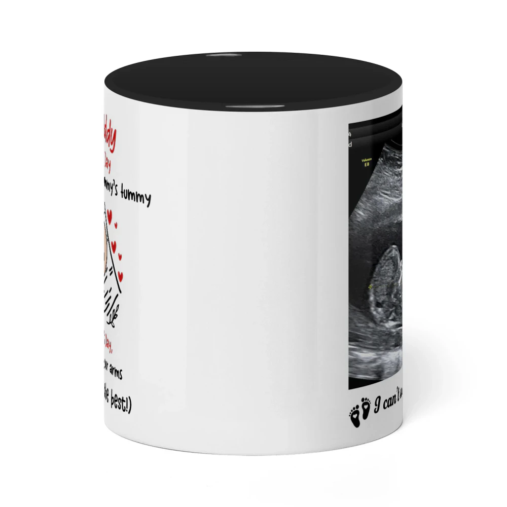 Personalized Dad To Be Two Tone Mug with Ultrasound Photo | First Father’s Day Gift for Expectant Dad | Custom New Daddy Coffee Mug