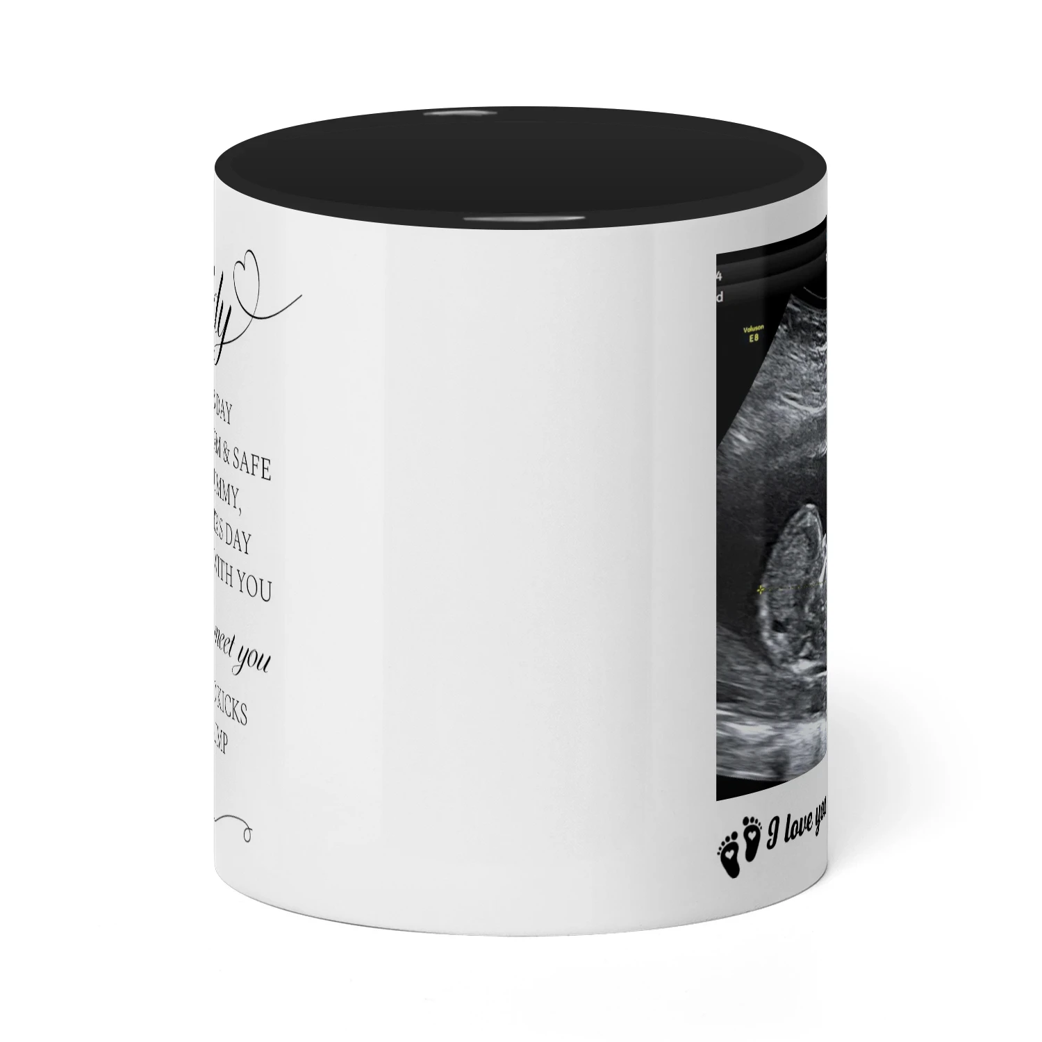 Personalized Dad To Be Two Tone Mug with Ultrasound Photo | First Father’s Day Gift for Expectant Dad | Custom New Daddy Coffee Mug
