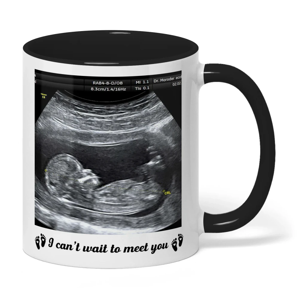 Personalized Dad To Be Two Tone Mug with Ultrasound Photo | First Father’s Day Gift for Expectant Dad | Custom New Daddy Coffee Mug