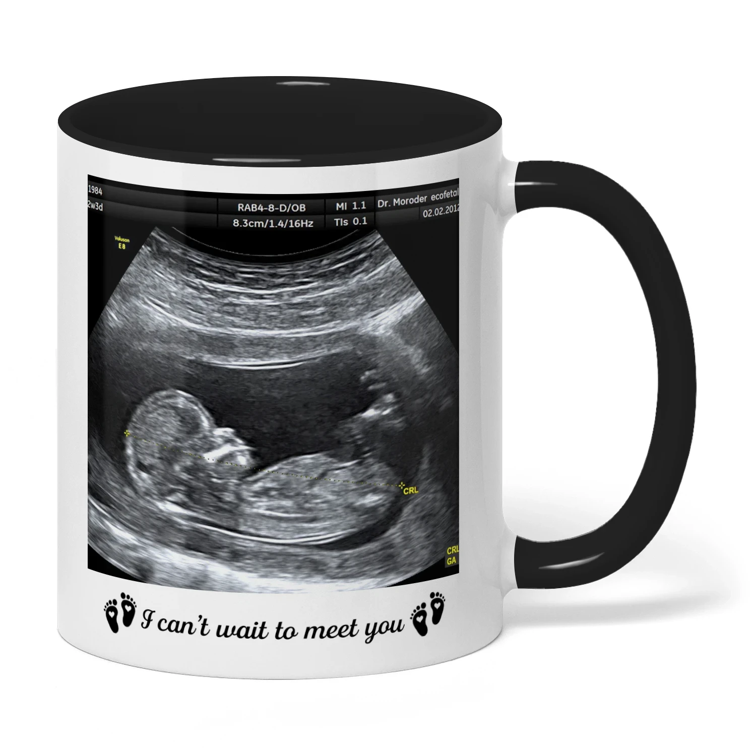 Custom Two Tone Mug For Mom To Be | First Mother's Day Gift For Expectant Mother | Personalized Coffee Mug With Ultrasound Picture