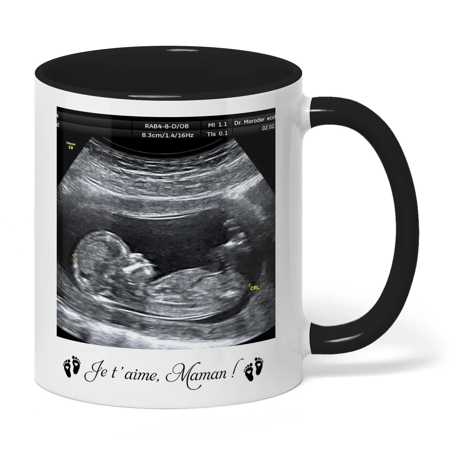 Mug bicolore personnalisé pour future maman | Premier cadeau de Fête des Mères pour femme enceinte | Tasse avec photo d’échographie