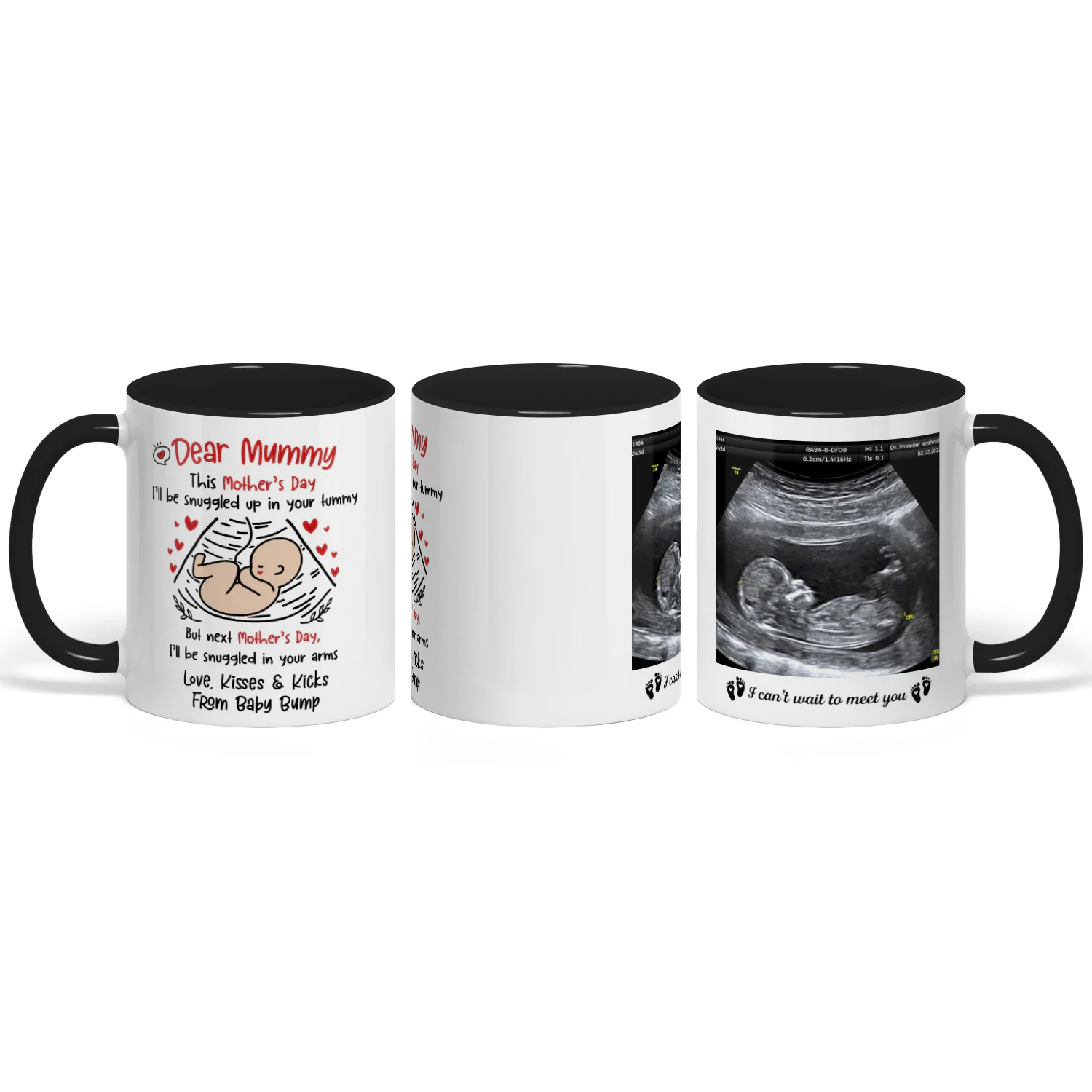 Custom Two Tone Mug For Mom To Be | First Mother's Day Gift For Expectant Mother | Personalized Coffee Mug With Ultrasound Picture