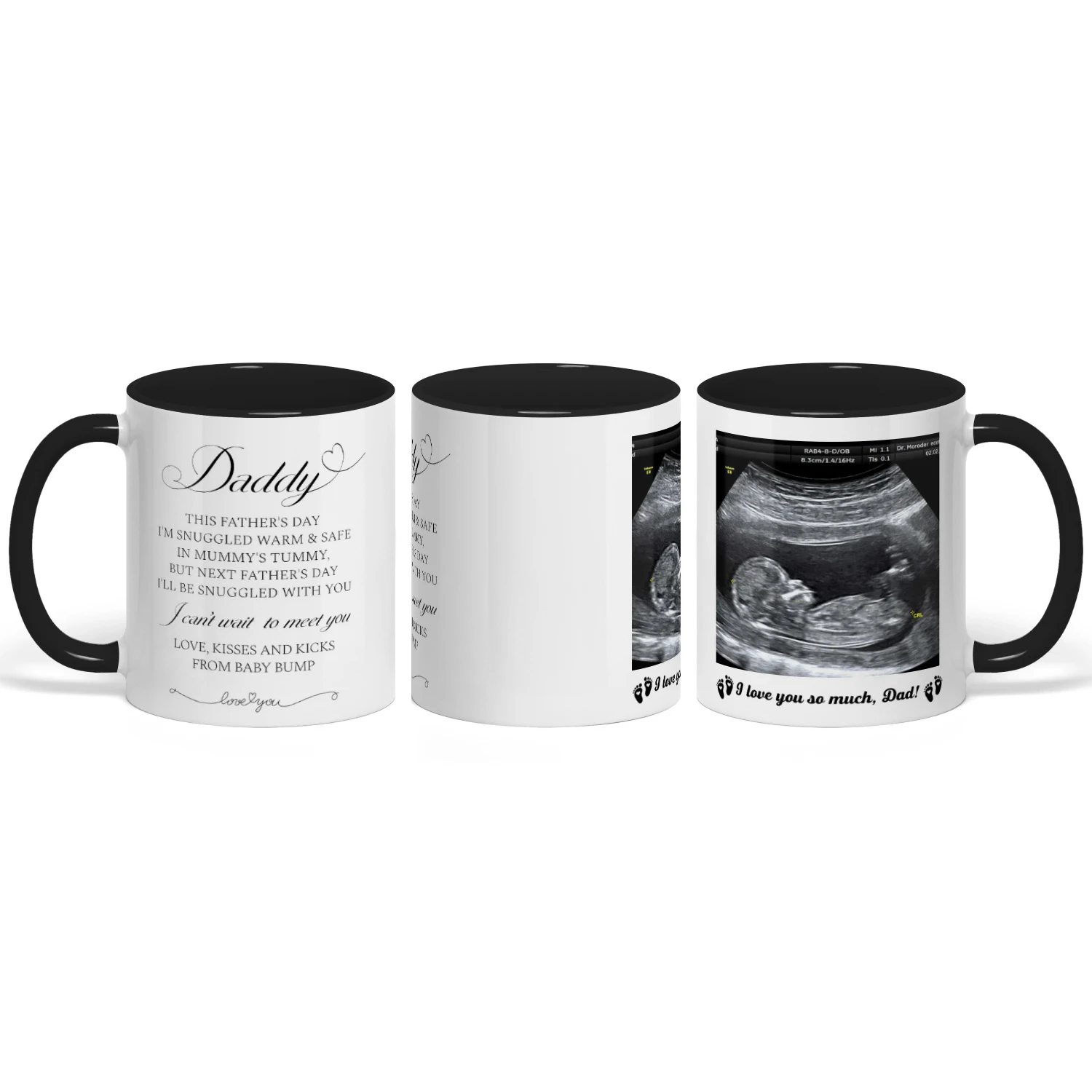 Personalized Dad To Be Two Tone Mug with Ultrasound Photo | First Father’s Day Gift for Expectant Dad | Custom New Daddy Coffee Mug