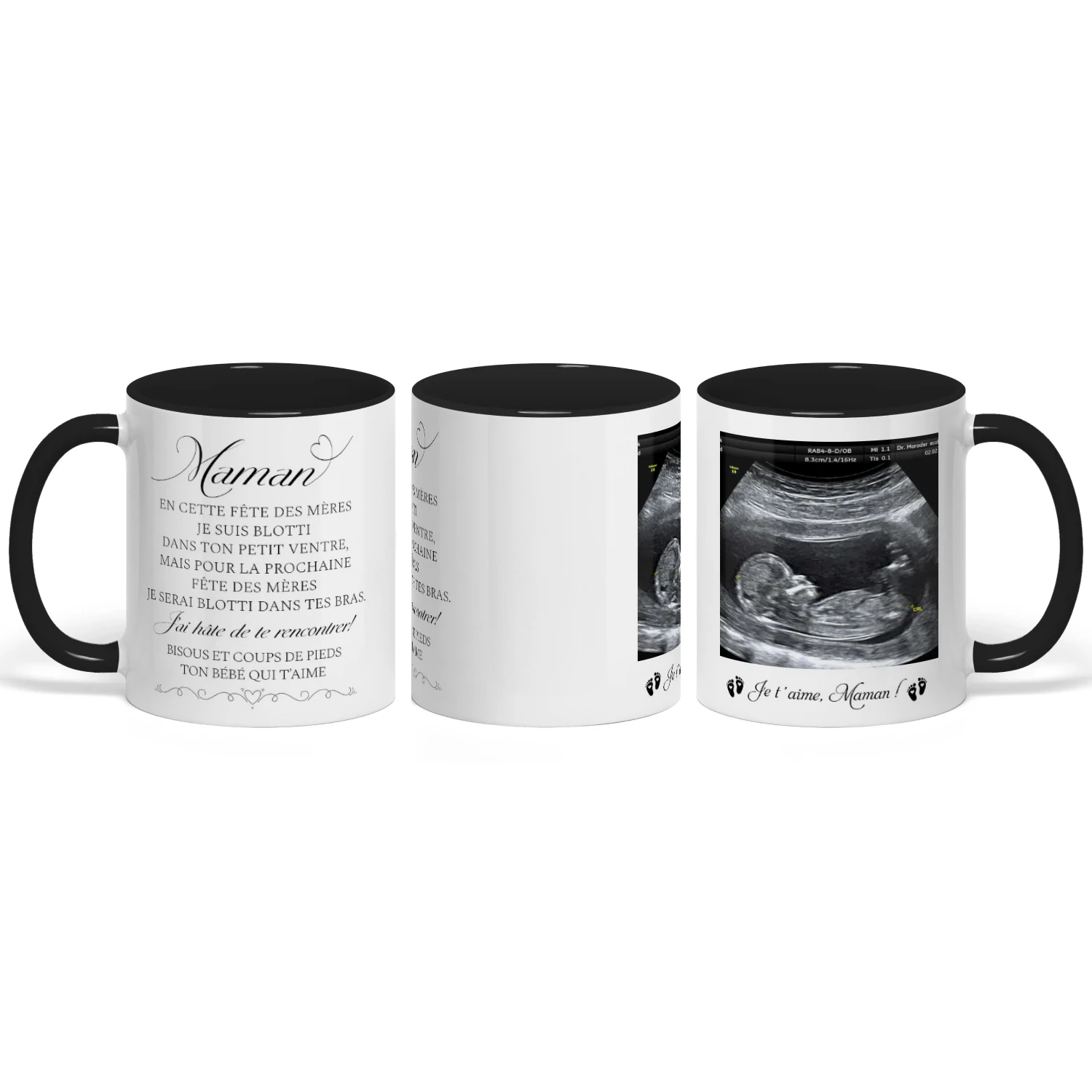 Mug bicolore personnalisé pour future maman | Premier cadeau de Fête des Mères pour femme enceinte | Tasse avec photo d’échographie