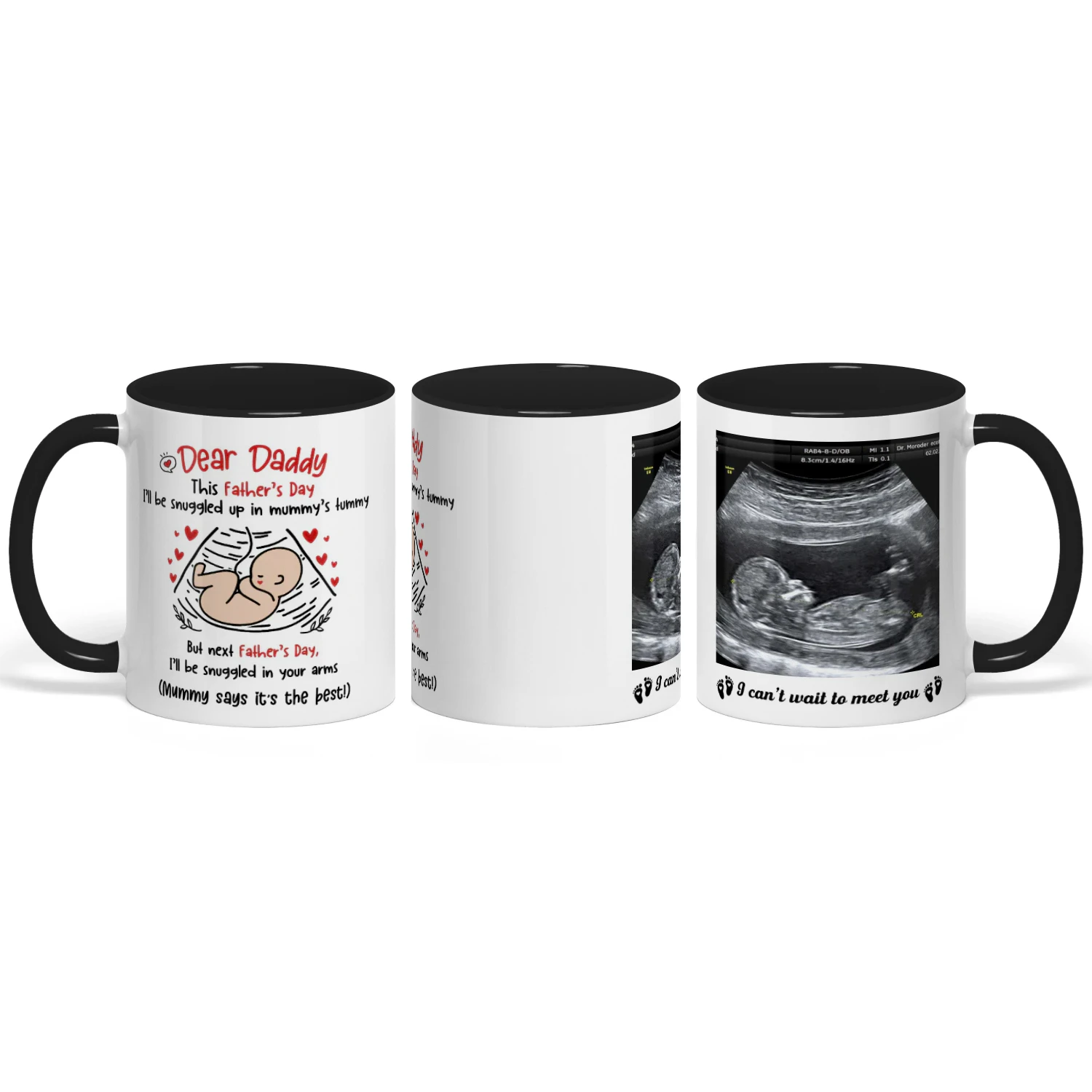 Personalized Dad To Be Two Tone Mug with Ultrasound Photo | First Father’s Day Gift for Expectant Dad | Custom New Daddy Coffee Mug