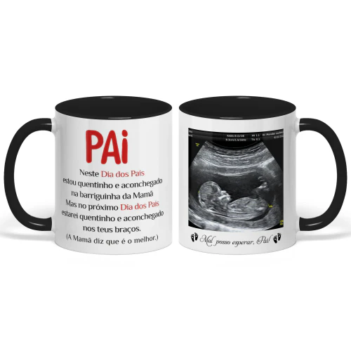 Caneca Bicolor Personalizada Para Futuro Papai | Presente Do Primeiro Dia Dos Pais | Caneca De Café Com Foto Do Ultrassom 2