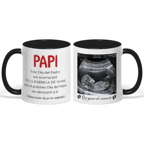 Taza Bicolor Personalizada Para Futuro Papá | Regalo Del Primer Día Del Padre | Taza De Café Con Foto De Ecografía 2