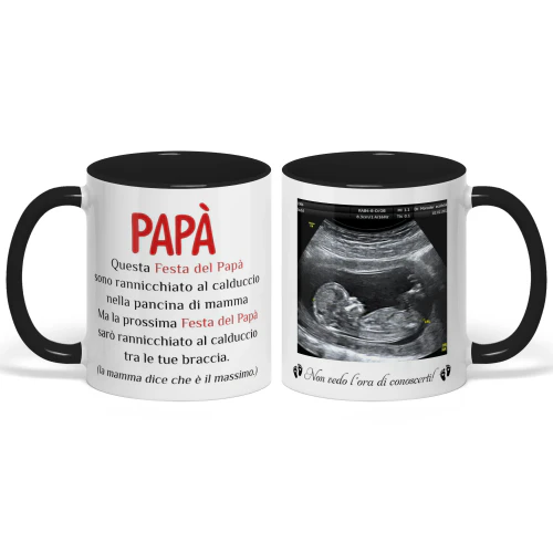Tazza Bicolore Personalizzata Per Futuro Papà | Regalo Per La Prima Festa Del Papà | Tazza Da Caffè Con Foto Dell'Ecografia 2