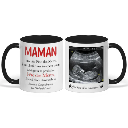 Mug bicolore personnalisé pour future maman | Premier cadeau de Fête des Mères pour femme enceinte | Tasse avec photo d’échographie – Ver 3