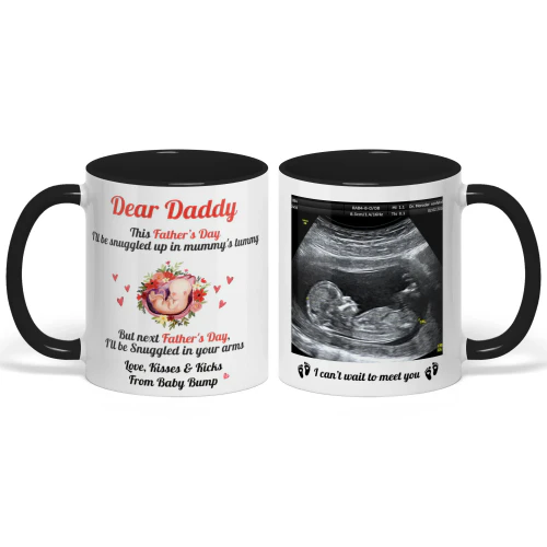 Custom Two Tone Mug For Dad To Be | First Father's Day Gift For Expectant Dad | Personalized Coffee Mug With Ultrasound Picture