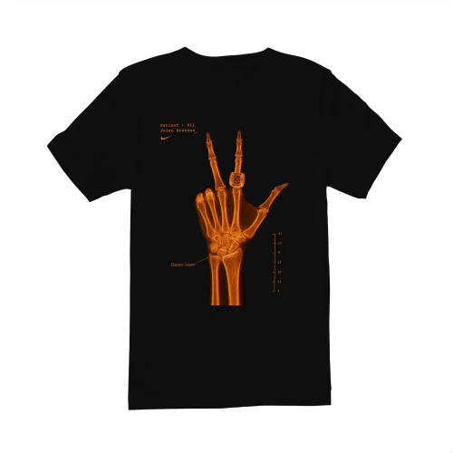 LIMITED EDITION 