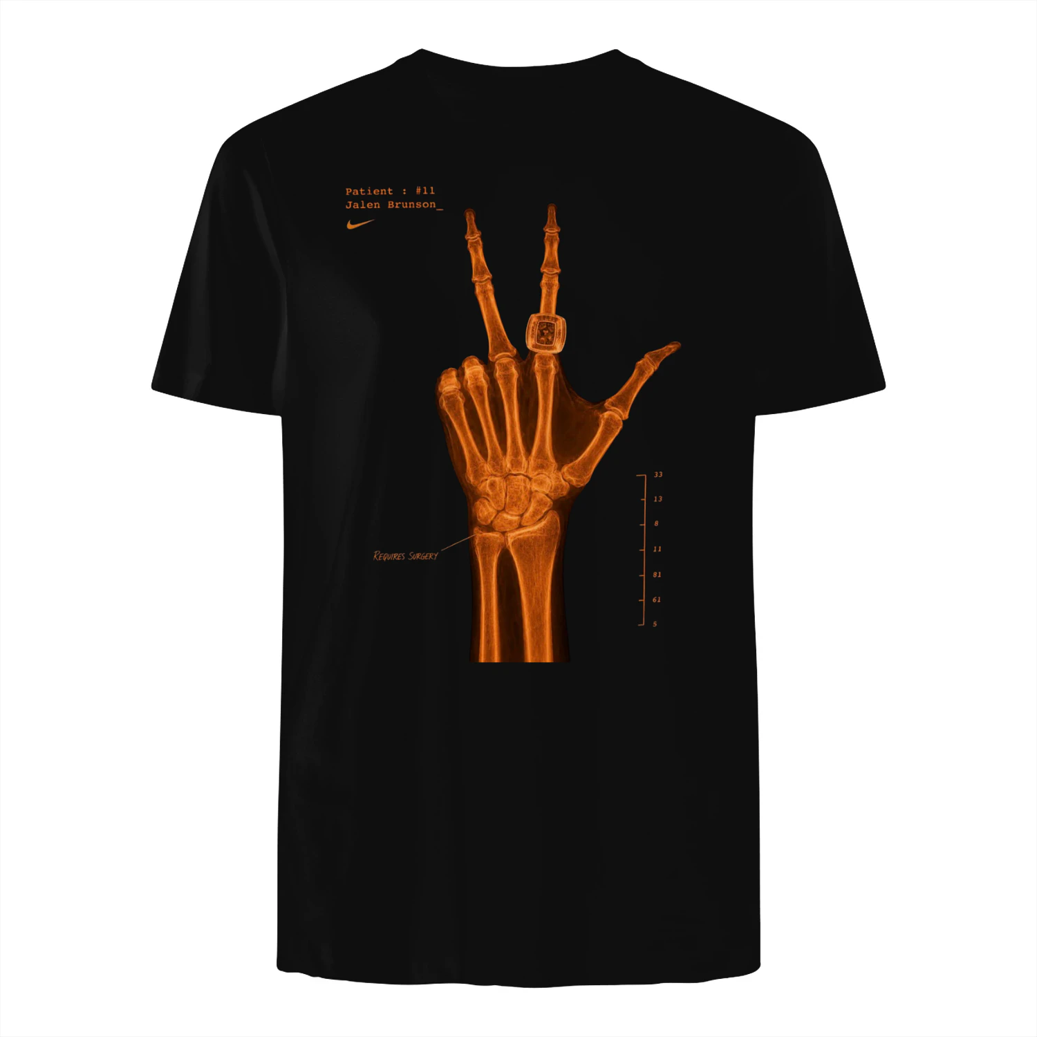 LIMITED EDITION 