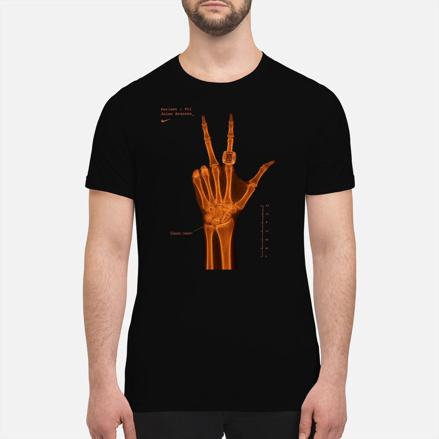 LIMITED EDITION 