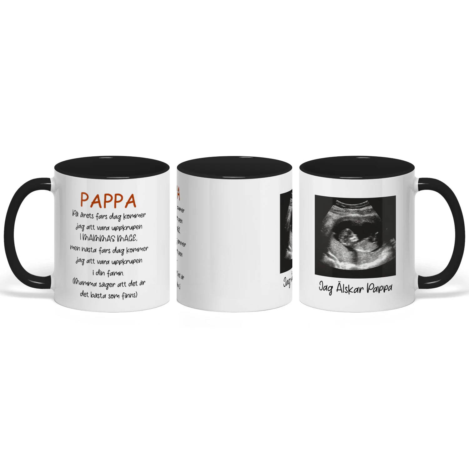 Personlig Mugg Med Bebisens Ultraljudsbild | Present Till Blivande Pappa | Fars Dag Jul Och Födelsedag
