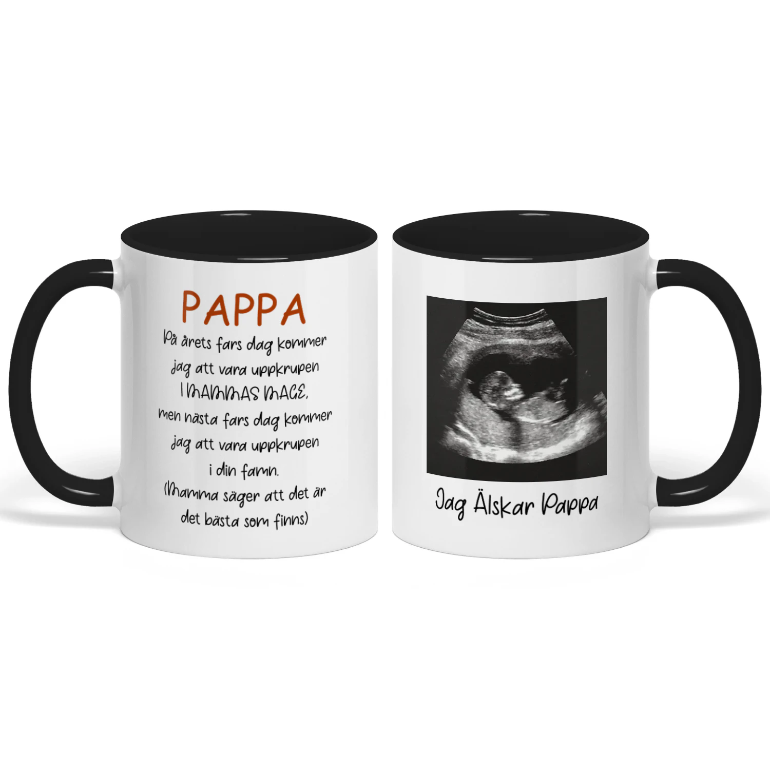 Personlig Mugg Med Bebisens Ultraljudsbild | Present Till Blivande Pappa | Fars Dag Jul Och Födelsedag