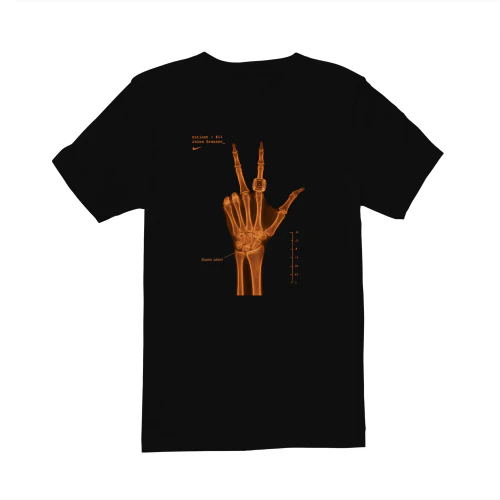 limited edition 