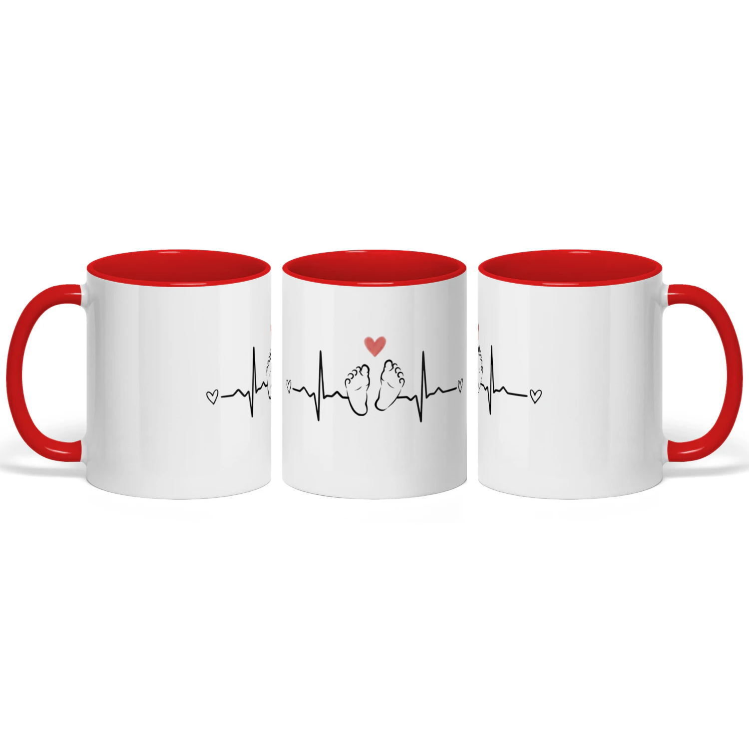 BabyBeat Mug- LIMITED EDITION