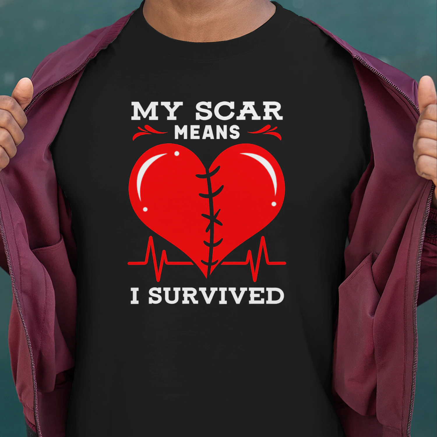 Open Heart Surgery My Scar Means I Survived