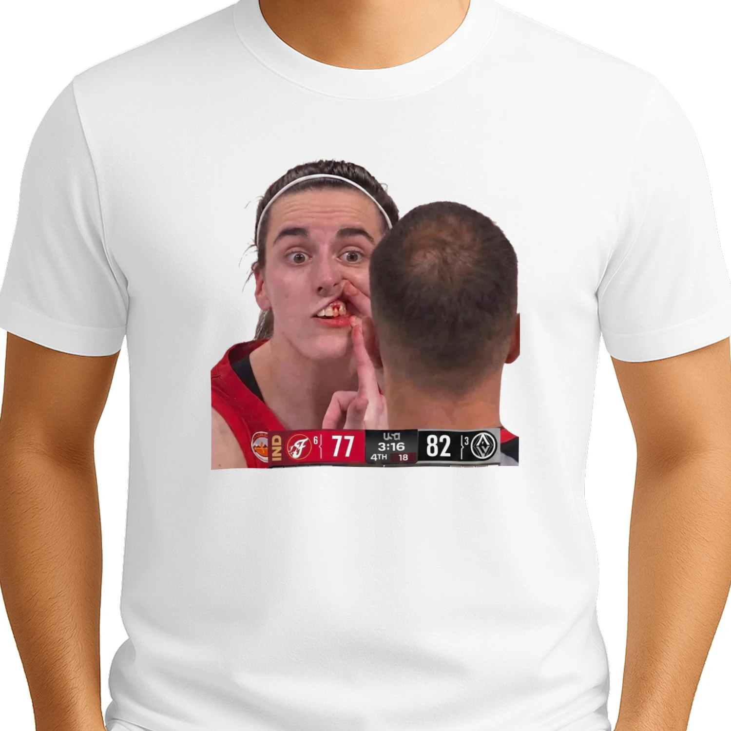 Caitlin Clark Bleeding From The Mouth T-shirt